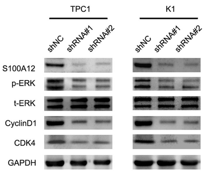 Western blot analysis of the expression levels of p-ERK,t-ERK,CyclinD1 and CDK4, in TPC1 and K1, after silencing S100A12.jpg